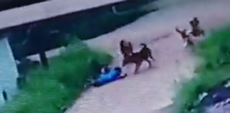 stray-dogs-attack-minor-boy