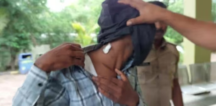 Man bites friend's neck, friend, Viral