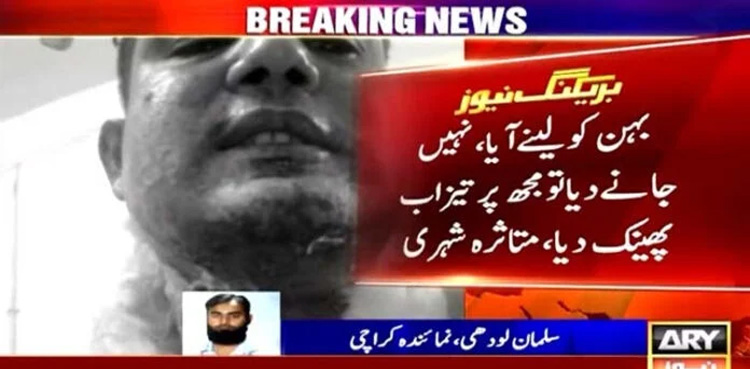 Acid attack, Karachi acid attack, domestic violence