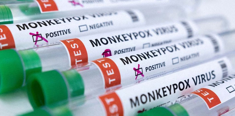 KP, detailed report, Monkeypox, NIH