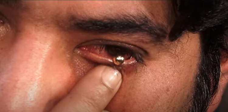 Haq Khateeb, pearls from the eye, trick exposed in public