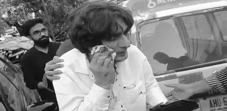 Investigation in Raoof Hassan attack case, Raoof Hassan attack case