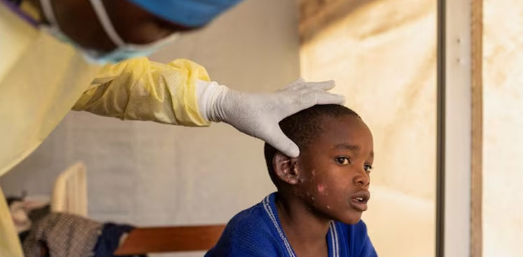 Thailand, new mpox strain, suspected case
