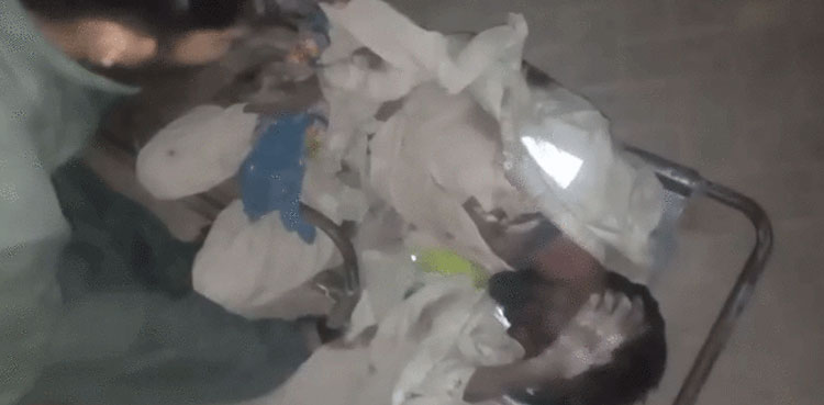 Hyderabad Civil Hospital doctors ‘refuse’ treatment to patient over foul odor